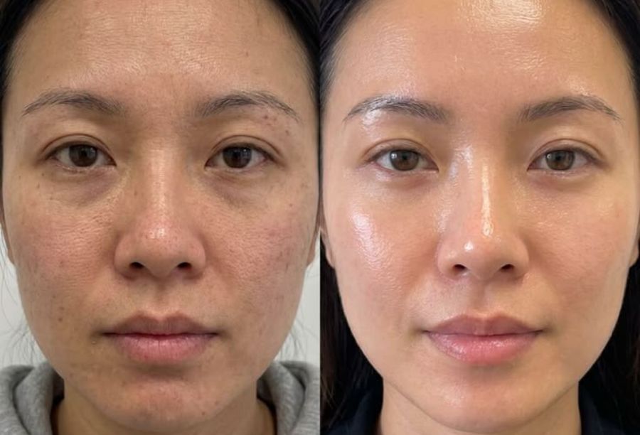 Before / After